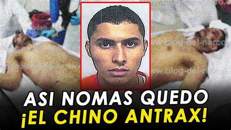 el chino antrax autopsy report.